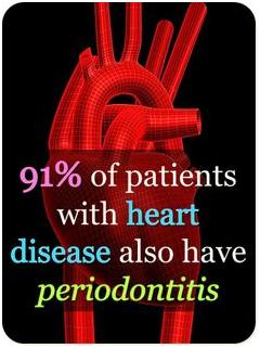 periodontis-heart