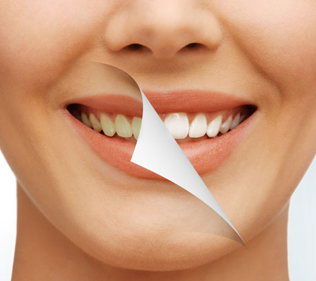 You can enhance your smile with professional teeth whitening from Integrative Dentistry